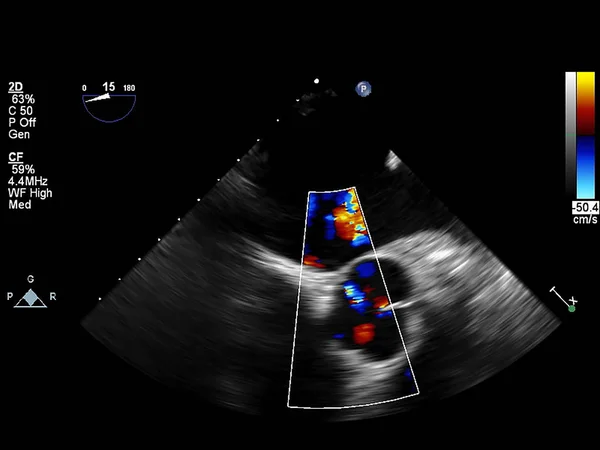 Diagnostic e cardiogram StockVektorbilder Depositphotos