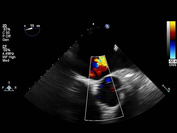 Tela da máquina de ecocardiografia (ultra-som) . — Fotografia de Stock