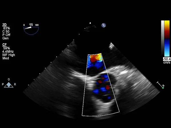 Ekokardiyografi (ultrason) makinesi nin ekranı. — Stok fotoğraf