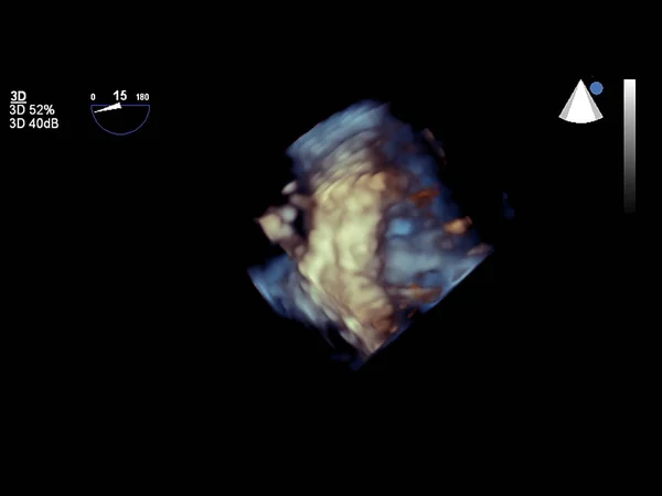 Nowoczesna Echokardiografia 3D. — Zdjęcie stockowe