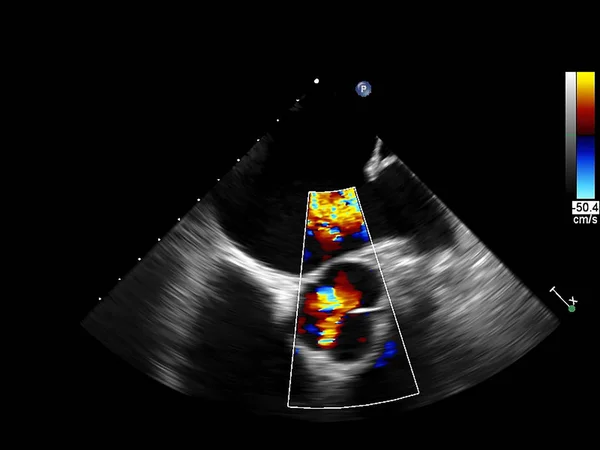 Tela da máquina de ecocardiografia (ultra-som) . — Fotografia de Stock