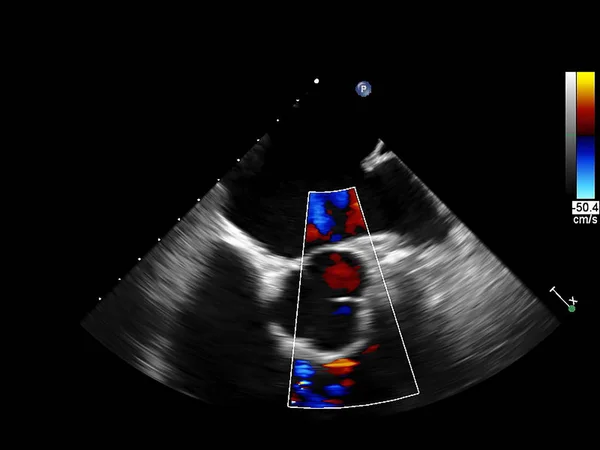Ekran echokardiografii (USG) maszyny. — Zdjęcie stockowe