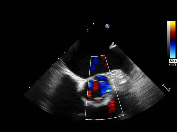 Ekran echokardiografii (USG) maszyny. — Zdjęcie stockowe