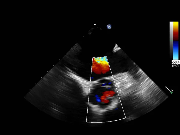 Tela da máquina de ecocardiografia (ultra-som) . — Fotografia de Stock