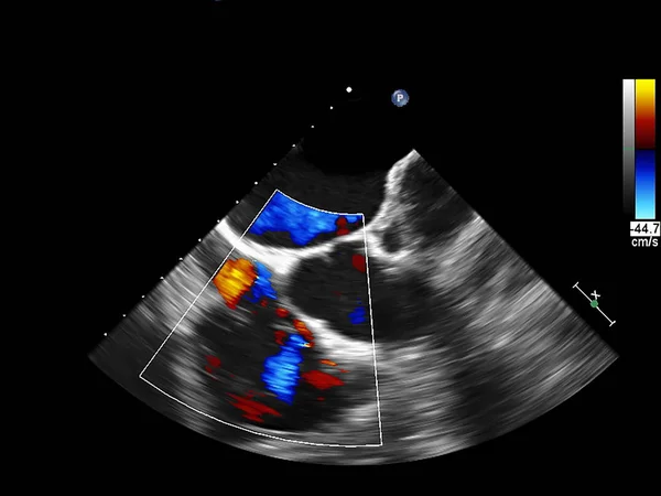 Ekokardiyografi (ultrason) makinesi nin ekranı. — Stok fotoğraf