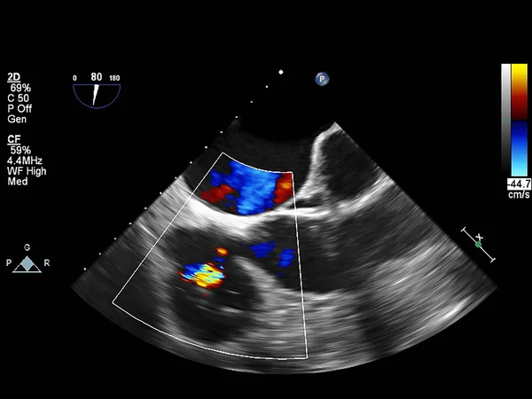 Экран эхокардиографической (ультразвуковой) машины . — стоковое фото