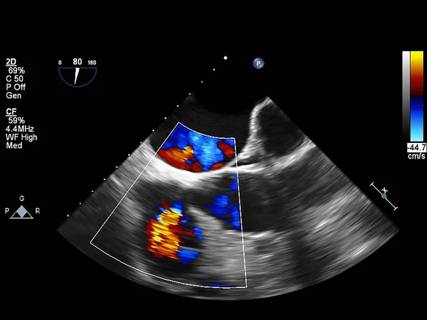 Ekran echokardiografii (USG) maszyny. — Zdjęcie stockowe