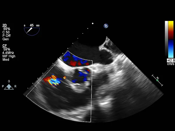 Scherm van echocardiografie (echografie) machine. — Stockfoto