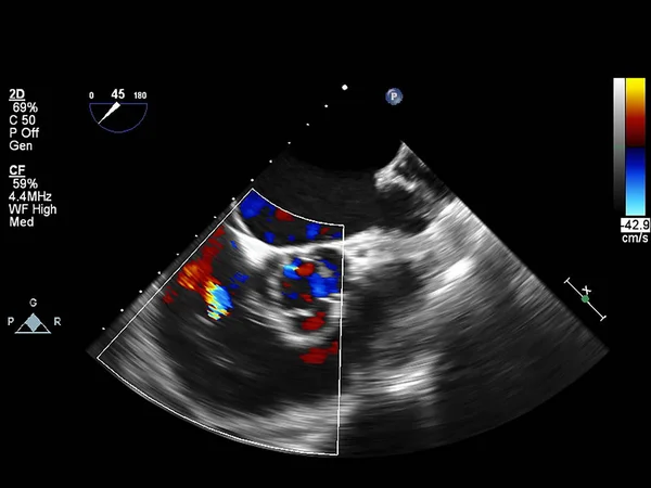 Scherm van echocardiografie (echografie) machine. — Stockfoto