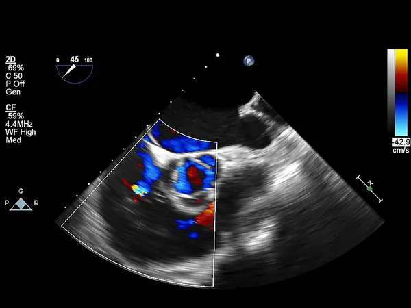 Ekran echokardiografii (USG) maszyny. — Zdjęcie stockowe