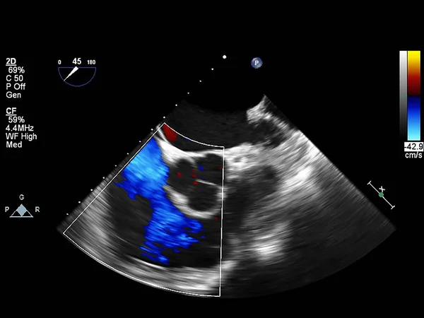 Écran de la machine d'échocardiographie (échographie) . — Photo