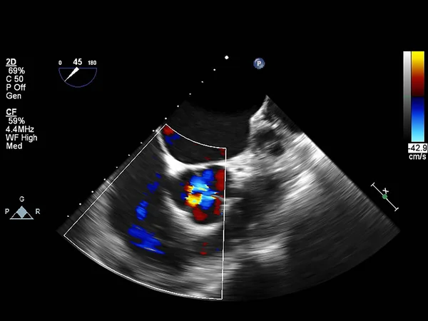 Pantalla de la máquina de ecocardiografía (ultrasonido) . — Foto de Stock