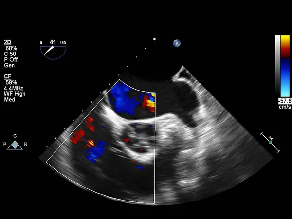 Tela da máquina de ecocardiografia (ultra-som) . — Fotografia de Stock