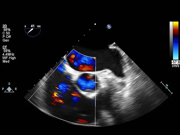 Scherm van echocardiografie (echografie) machine. — Stockfoto