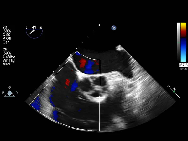 Pantalla de la máquina de ecocardiografía (ultrasonido) . —  Fotos de Stock