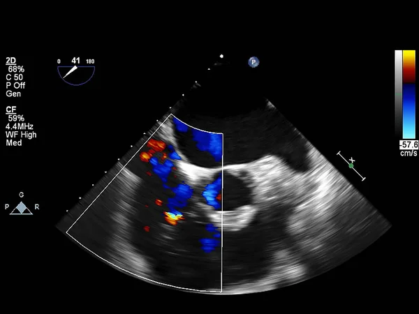 Tela da máquina de ecocardiografia (ultra-som) . — Fotografia de Stock