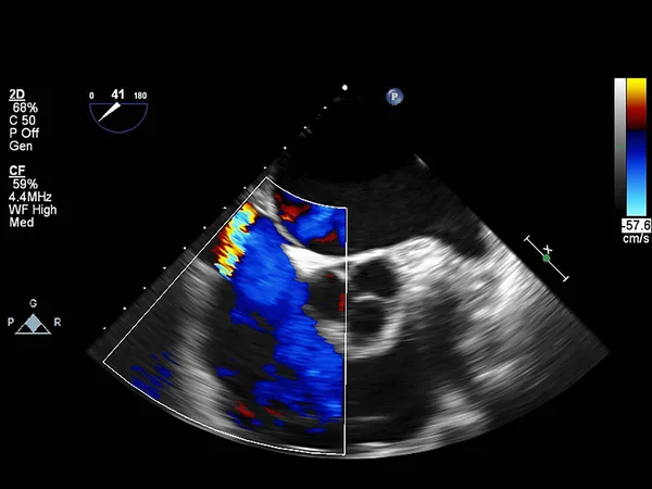 Tela da máquina de ecocardiografia (ultra-som) . — Fotografia de Stock