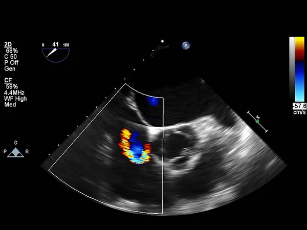 Ekokardiyografi (ultrason) makinesi nin ekranı. — Stok fotoğraf
