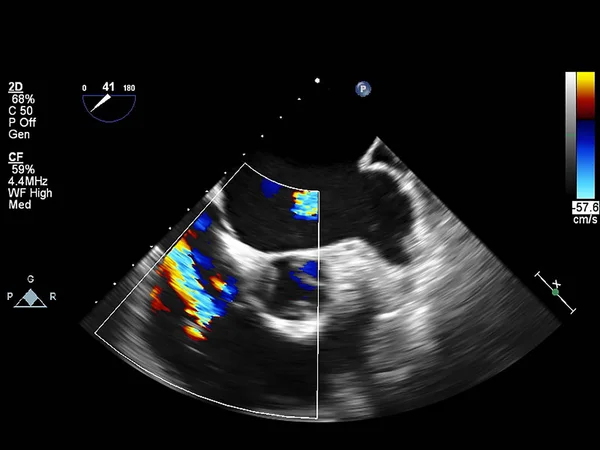 Ekran echokardiografii (USG) maszyny. — Zdjęcie stockowe