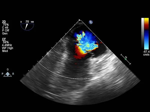 Pantalla de la máquina de ecocardiografía (ultrasonido) . —  Fotos de Stock