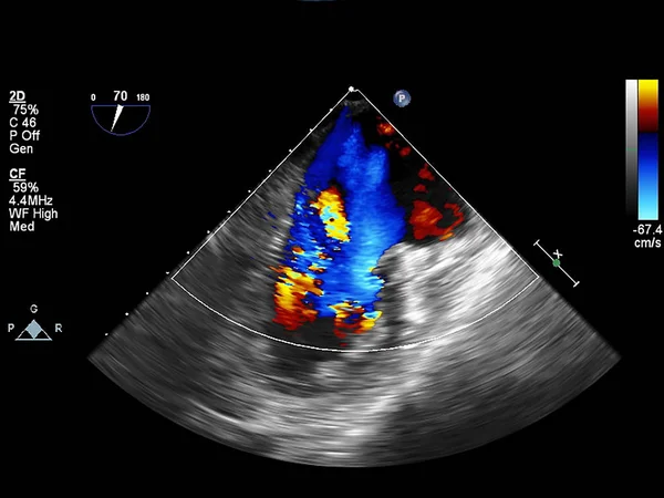 Scherm van echocardiografie (echografie) machine. — Stockfoto