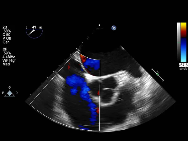 Pantalla de la máquina de ecocardiografía (ultrasonido) . —  Fotos de Stock