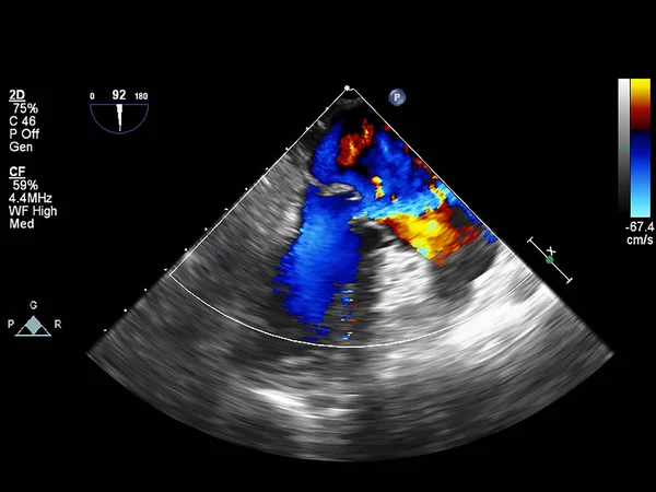 Pantalla de la máquina de ecocardiografía (ultrasonido) . — Foto de Stock