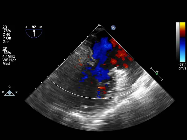 Scherm van echocardiografie (echografie) machine. — Stockfoto