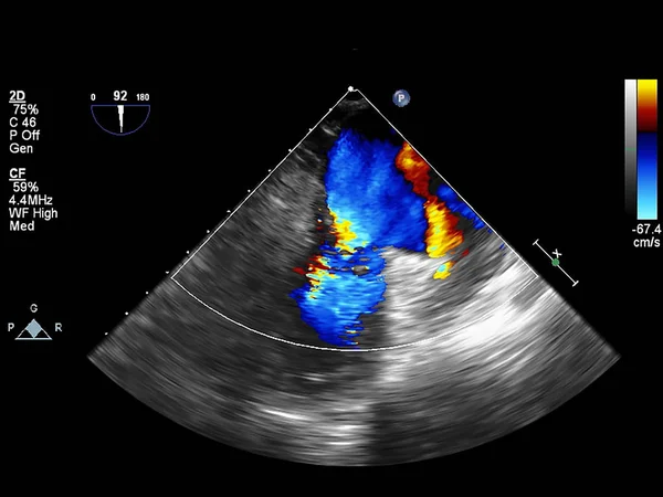 Pantalla de la máquina de ecocardiografía (ultrasonido) . —  Fotos de Stock