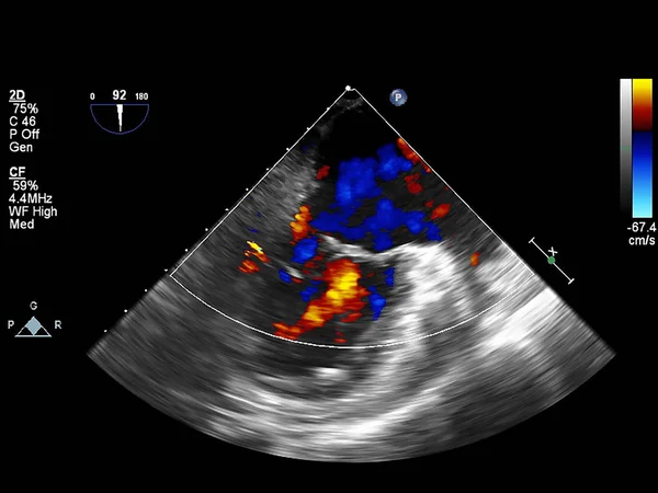 Tela da máquina de ecocardiografia (ultra-som) . — Fotografia de Stock