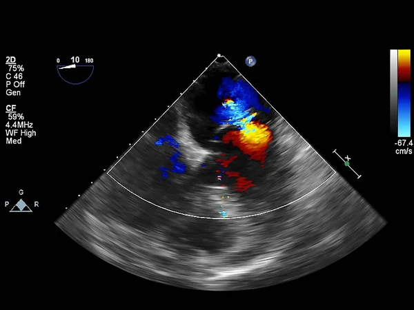 Mesin echocardiography (ultrasound) layar . — Stok Foto