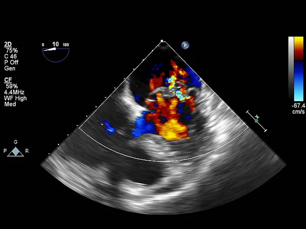 Scherm van echocardiografie (echografie) machine. — Stockfoto