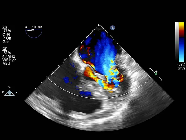 Obrazovka počítače s echokardiografií (ultrazvukem). — Stock fotografie