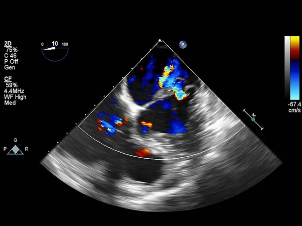 Tela da máquina de ecocardiografia (ultra-som) . — Fotografia de Stock