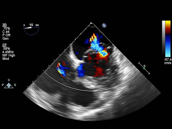 Scherm van echocardiografie (echografie) machine. — Stockfoto