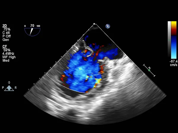 Scherm van echocardiografie (echografie) machine. — Stockfoto