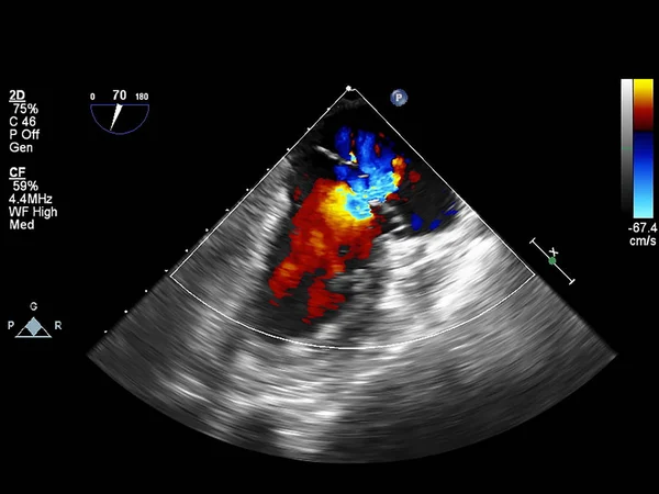 Pantalla de la máquina de ecocardiografía (ultrasonido) . — Foto de Stock