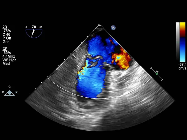 Tela da máquina de ecocardiografia (ultra-som) . — Fotografia de Stock