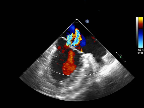 Écran de la machine d'échocardiographie (échographie) . — Photo