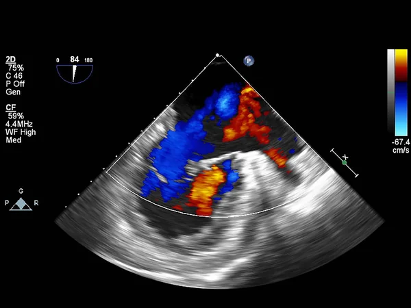 Écran de la machine d'échocardiographie (échographie) . — Photo