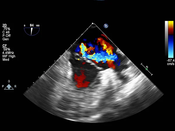 Écran de la machine d'échocardiographie (échographie) . — Photo