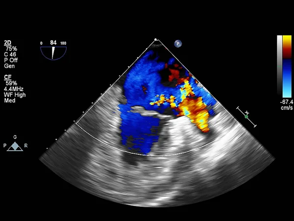 Pantalla de la máquina de ecocardiografía (ultrasonido) . — Foto de Stock