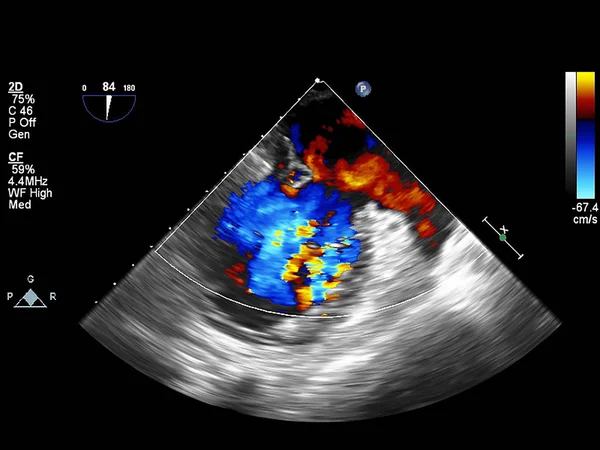 Tela da máquina de ecocardiografia (ultra-som) . — Fotografia de Stock