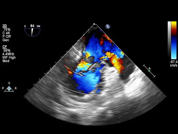 Écran de la machine d'échocardiographie (échographie) . — Photo