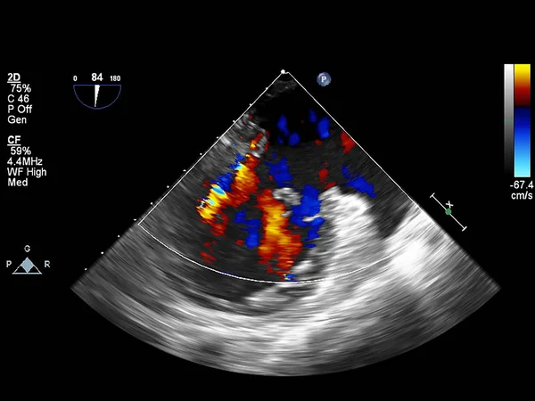 Écran de la machine d'échocardiographie (échographie) . — Photo