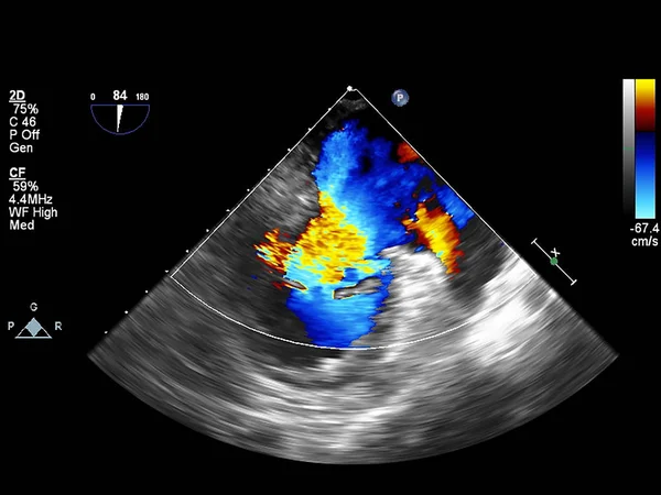 Écran de la machine d'échocardiographie (échographie) . — Photo