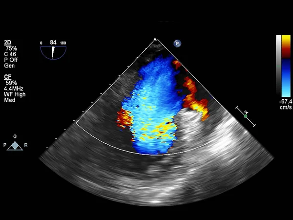 Ekokardiyografi (ultrason) makinesi nin ekranı. — Stok fotoğraf
