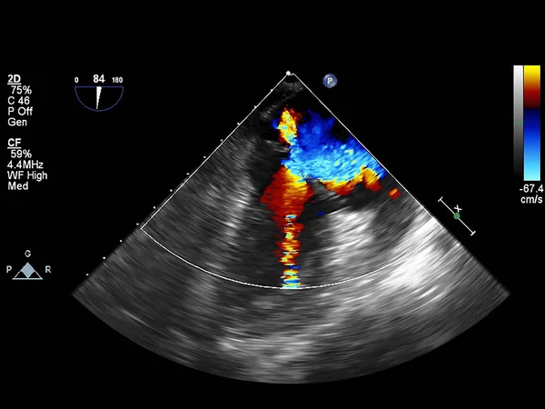 Pantalla de la máquina de ecocardiografía (ultrasonido) . —  Fotos de Stock