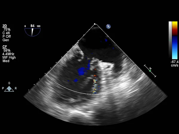 Pantalla de la máquina de ecocardiografía (ultrasonido) . — Foto de Stock