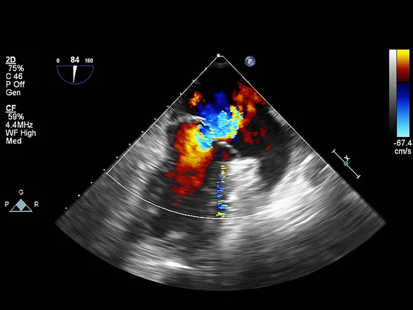 Écran de la machine d'échocardiographie (échographie) . — Photo